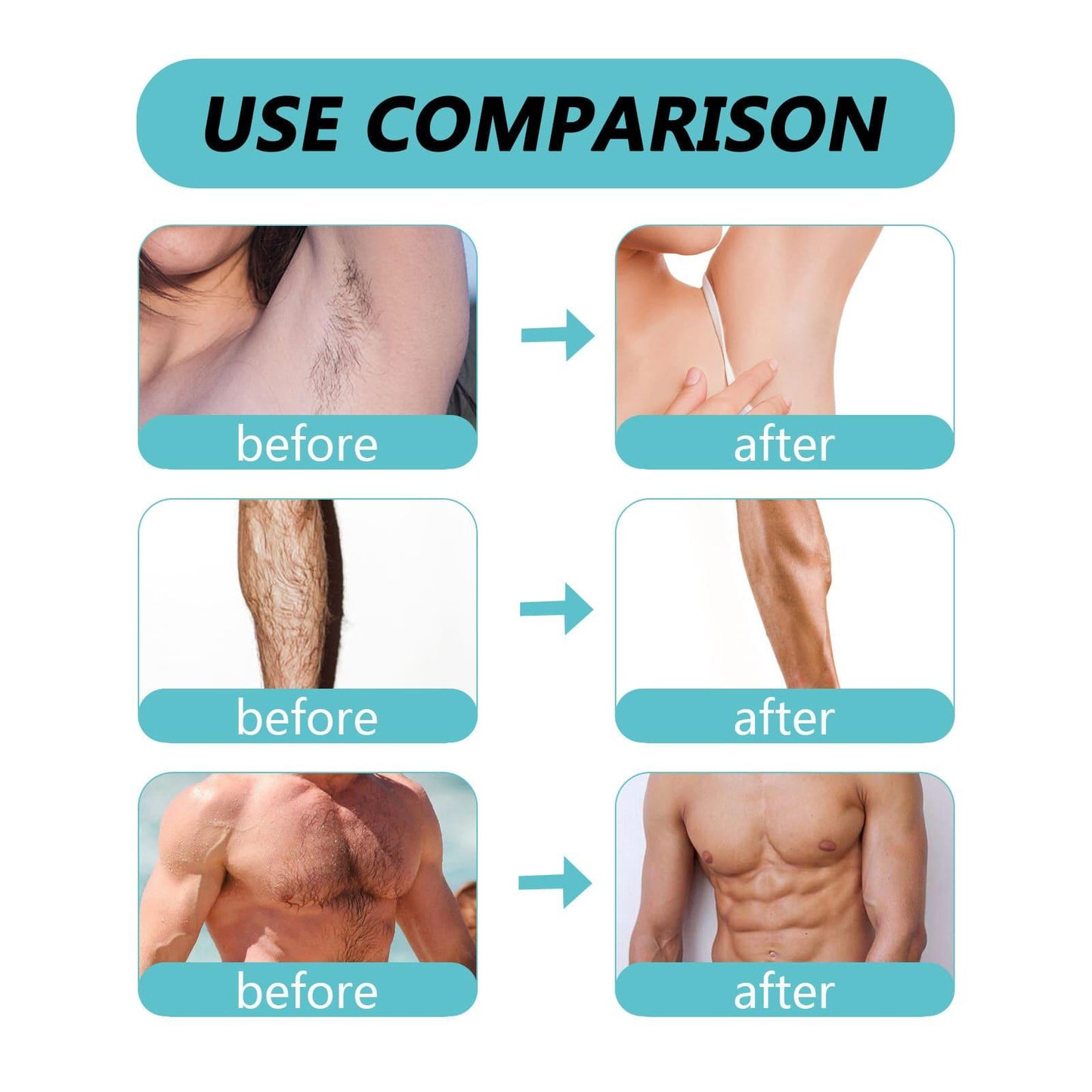 Ecrin Hair Removal Spray – Genuine & Powerful Formula for Smooth, Silky Skin